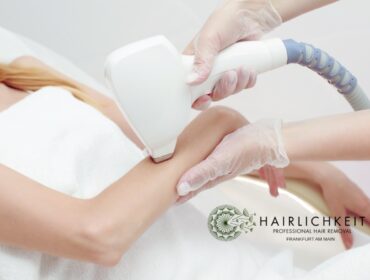 Abstände bei Laser-Haarentfernung